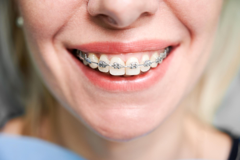 orthodontic services  San Leandro, CA
